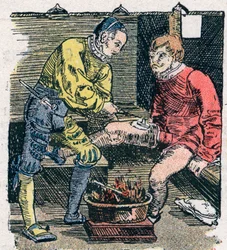 Kirurg ger ett sår 1528.