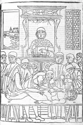 Anatomisk dissektion. Gravyr från en avhandling av medicin av Gerolamo Cardano (Cardanus Hieronymus), Florens
