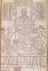 Obduktion. Codice. Kroppen av en död man dissekerar av läkare för en anatomistudie. “” Fasciculus Medicinae””. Codex för en doktors fascikel av Johannes Kethan