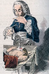 Trepanationen. Tryck från 1700-talet.