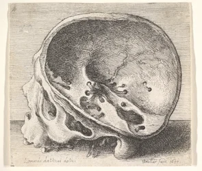 Sektionerad skalle i profil till vänster med vänster sida av kraniet borttagen, 1651.