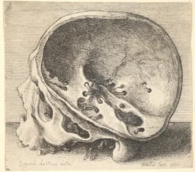Sektionerad skalle i profil till vänster med vänster sida av kraniet borttagen, 1651.