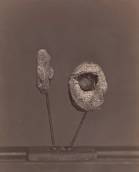 Utskuren knäled. En rund muskötboll i den inre kondylen på höger lårbenet [Gardin..., 1866-67.