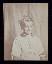 Psykiatri Porträtt av en patient, Surrey County Asylum, ca 1852